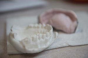 Fixed Bridges in Florence | Dentures in Florence | Florence Dentures